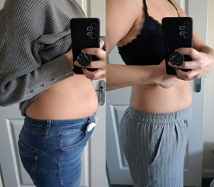 Flash Sale ⚡ Buy 1, Get 50% Off — Say Goodbye to Bloating and Gut Discomfort