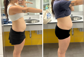Flash Sale ⚡ Buy 1, Get 50% Off — Say Goodbye to Bloating and Gut Discomfort