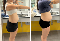 Flash Sale ⚡ Buy 1, Get 50% Off — Say Goodbye to Bloating and Gut Discomfort